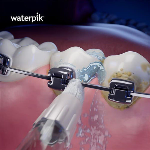 Orthodontic Tip OD-100E